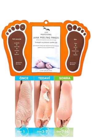 2. Ürün 1 Tl Ayak Topuk Soyucu Çorap Maske Ölü Deri Soyan Ayak Çorabı MjCare Peeling Maskesi ZZ845LA - 6