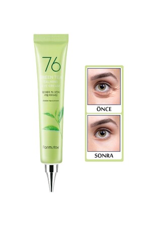 %76 Yeşil Çay Içeren Koyu Halka Ve Kırışıklık Karşıtı Yatıştırıcı Göz Kremi 45 ml - Farmstay