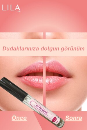 Aromalı Dudak Dolgunlaştırıcı & Dudak Parlatıcı - Lila Soft