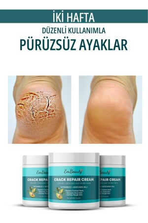 Ayak & Topuk Çatlak Onarıcı Beyazlatıcı Etkili Krem 150 ML - 4