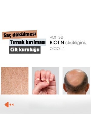 Biotin (ÇİNKO ÇÖREKOTU CİVAN PERÇEMİ AT KUYRUĞU ISIRGAN EKSTRESİ) 60 Kapsül - 5