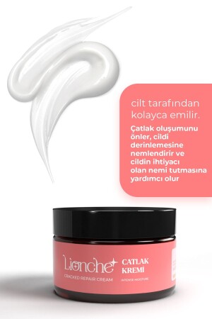 Çatlak Önleyici Bakım Kremi (HAMİLELİK ÇATLAKLARI) 100 ml - 5