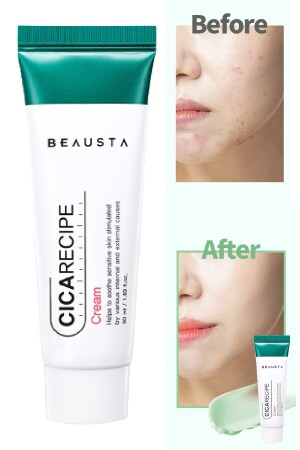 Cica Anti-Akne-Feuchtigkeitscreme, die die Barrierereparatur unterstützt. Cica Repair Cream 50 ml TYCWYJPSTN168673901021625 - 2