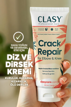 El, Diz Ve Dirsek Bakım Kremi - Çatlamış, Kurumuş, Koyulaşmış Sert Deriye Karşı - Clasy Care