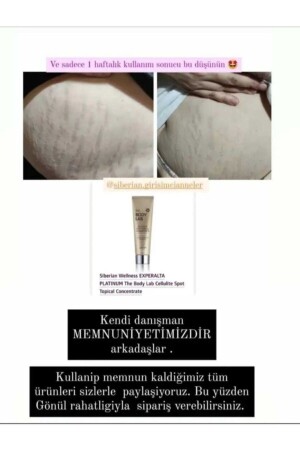 Experalta Platinum The Body Lab Cellulite Spot Topisches Konzentrat 150 ml - 6