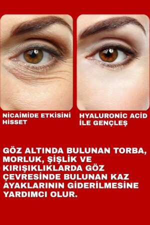 Göz Altı Torba Ve Morluk & Koyu Halka Karşıtı Yoğun Nemlendirici Ile Göz Altı Aydınlatıcı Krem 50 Ml - 7