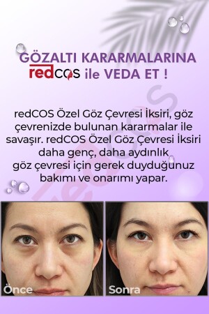 Gözaltı Bakım Iksiri Nemlendirici- Dengeleyici- Yorgun Görünüm- Morluk Giderici - Under-eye Elixir - 3