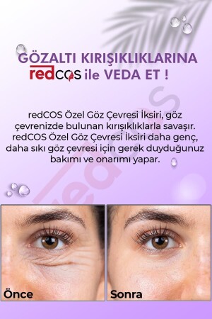 Gözaltı Bakım Iksiri Nemlendirici- Dengeleyici- Yorgun Görünüm- Morluk Giderici - Under-eye Elixir - 4