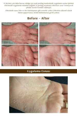 Hand Peeling - Soyulan El Peeling Maskesi - 5