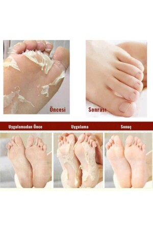 Miracle Foot Peeling Pack - Mjcare Çorap Tipi Ayak Peeling Maskesi 1518070 - 3