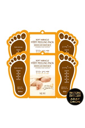 MNZ-Miracle Foot Peeling Pack - نوع الجوارب قناع قناع قناع 2 - Mjcare