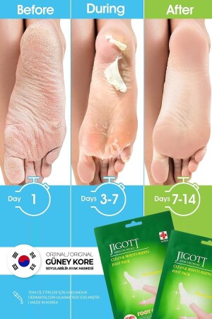 قناع قذائف من نوع MNZ-Sock Peel-Off Foot Peeling Mask - Miracle Foot Peeling Pack - Jigott
