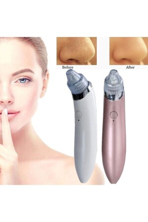 جهاز إزالة السلطة (MNZ-Vacuum Blackhead Acne Removal Device) العثور على (st-vkm1) - Satfinder