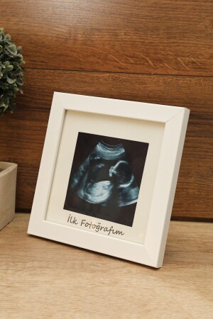 MNZ-ZD Store أول صورة لي طفل فوق الصوتية إطار أبيض - Aksesuar
