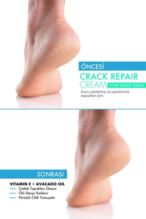 MRS.UMRANTOO Crack Repair Cream Çatlak Onarıcı Ayak Bakım Kremi 100 ml - 4