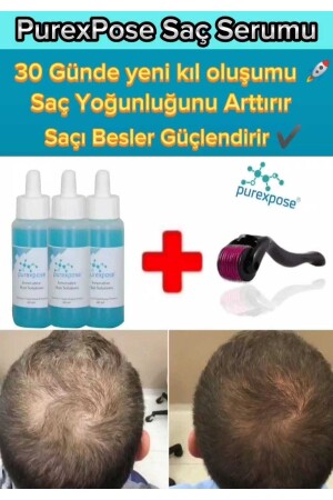 Saç Bakım Saç Çıkarmaya Yardımcı Onarıcı Uzatıcı Besleyici Serum 3 1 Dermaroller 9145455876745 - 2