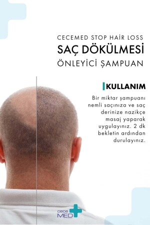 Saç Dökülmesi Önleyici Şampuan 300 Ml - 4