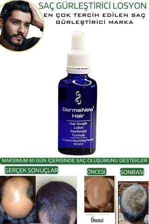 Saç Gürleştirici Serum Roller Mavi Şampuan Hediyeli - -5x50ml - 4