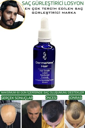 Saç Gürleştirici Serum Roller Mavi Şampuan Hediyeli - -5x50ml - 5