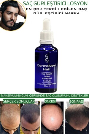 Saç Gürleştirici Serum Roller Mavi Şampuan Hediyeli - -5x50ml - 7