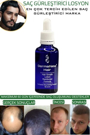 Saç Gürleştirici Serum Roller Mavi Şampuan Hediyeli - -5x50ml - 8