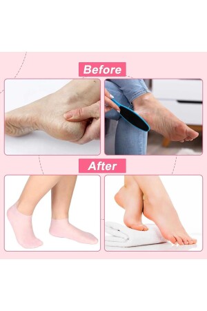 Silikon nemlendirici Spa jeli topuk çorap ayak bakımı çorap - 2