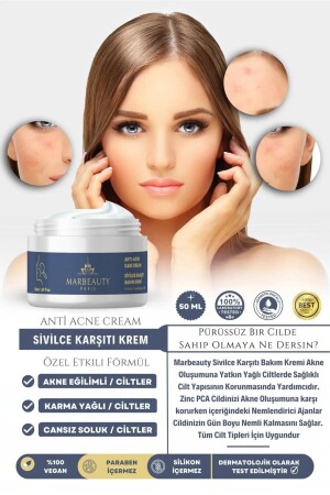 Sivilce Önleyici Ve Sivilce Karşıtı Leke,giderici Akne Siyah Nokta Önleyici Krem 50ml MPARİS-05 - 1