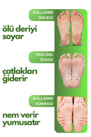 Soyulabilir Ayak Maskesi Peeling Etkili Ölü Deri Ve Çatlaklar İçin Aloe Vera Özlü 100ml - 4