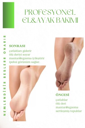 Soyulabilir Ayak Maskesi Peeling Etkili Ölü Deri Ve Çatlaklar İçin Aloe Vera Özlü 100ml - 6