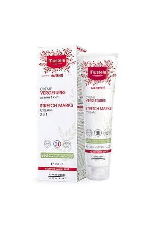 Stretch Marks Prevention Cream Çatlak Öncesi Kremi 150 ml - 1