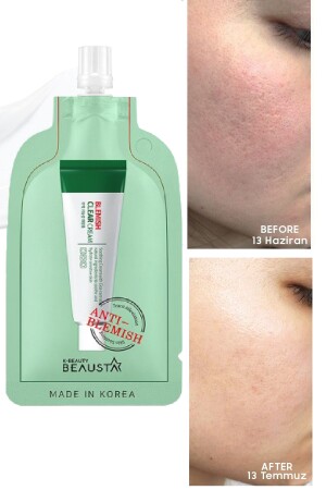 كريم مكافحة الحمى والعيب TYC6GC5KCN168673864936221 - BEAUSTA