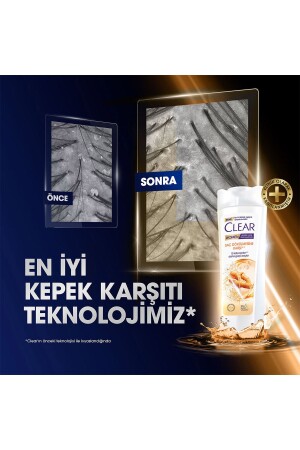 Women Kepeğe Karşı Etkili Şampuan Saç Dökülmesine Karşı 350 ml X3 - 5