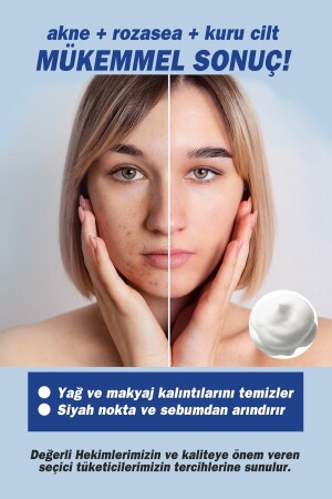 Yüz Temizleme Köpüğü 200 Ml ( Aplikatörlü ) (çay Ağacı Yağı - Tea Tree Oıl) 8680145083094 - 5